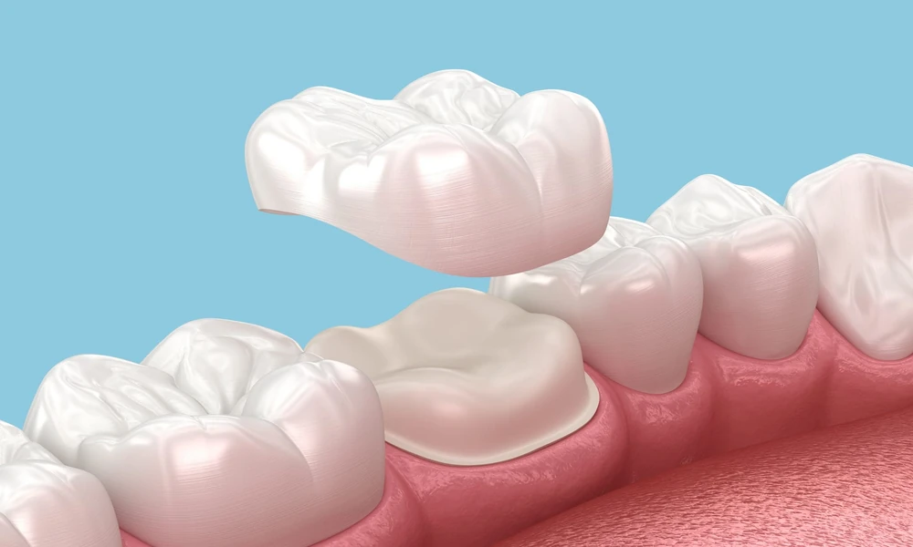 How General Dentistry Provides Affordable Solutions For Preventive Needs